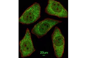 Immunofluorescent analysis of A549 cells, using MSRA Antibody (N-term) (ABIN391489 and ABIN2841456). (MSRA antibody  (N-Term))