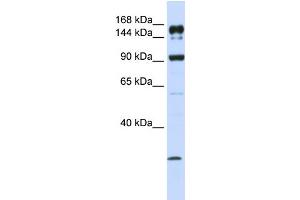 WB Suggested Anti-ABCA5 Antibody Titration:  1 ug/ml  Positive Control:  MCF-7 whole cell lysates (ABCA5 antibody  (C-Term))