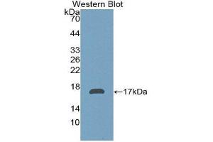 Western Blotting (WB) image for anti-alpha-2-Glycoprotein 1, Zinc-Binding (AZGP1) (AA 180-298) antibody (ABIN1171666) (AZGP1 antibody  (AA 180-298))