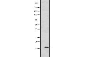 Western blot analysis of HSPB9 expression in A549 cell line lysates ,The lane on the left is treated with the antigen-specific peptide. (HSPB9 antibody  (C-Term))