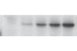 Western Blotting (WB) image for anti-Tumor Protein P53 (TP53) (pSer46) antibody (ABIN3201005) (p53 antibody  (pSer46))
