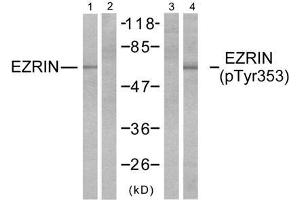 Western blot analysis of extracts from A431 cells, untreated or EGF-treated (200ng/ml, 30min), using Ezrin (Ab-353) antibody (E021094, Lane 1 and 2) and Ezrin (phospho-Tyr353) antibody (E011063, Lane 3 and 4). (Ezrin antibody  (pTyr353))