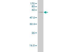 Western Blotting (WB) image for anti-phosphoglycerate Dehydrogenase (PHGDH) (AA 1-533) antibody (ABIN565240)