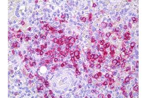 Anti-CD45RB antibody IHC of human spleen, lymphocytes. (CD45RB antibody)