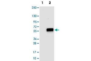 Western blot analysis of Lane 1: Negative control (vector only transfected HEK293T lysate), Lane 2: Over-expression Lysate (Co-expressed with a C-terminal myc-DDK tag (~3. (MAT2A antibody)