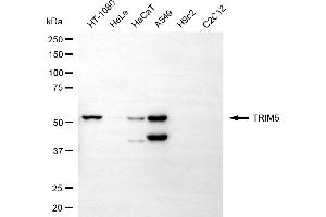 Western blotting analysis using TRIM5 antibody (ABIN7800638).
