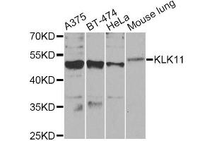 Western blot analysis of extracts of various cell lines, using KLK11 Antibody. (Kallikrein 11 antibody)