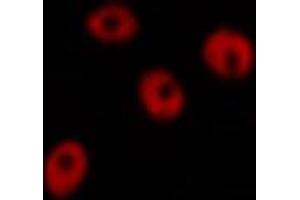 Immunofluorescence (fixed cells) (IF/ICC) image for anti-Checkpoint Kinase 2 (CHEK2) (pThr383) antibody (ABIN6256552)