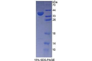 SDS-PAGE analysis of Human PMM1 Protein. (PMM1 Protein)