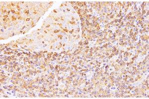 Immunohistochemistry of paraffin-embedded Human tonsil using Anxa6 Polyclonal Antibody at dilution of 1:100 (ANXA6 antibody)