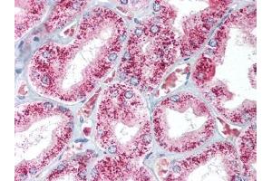 Image no. 1 for anti-Catalase (CAT) antibody (ABIN302905) (Catalase antibody)