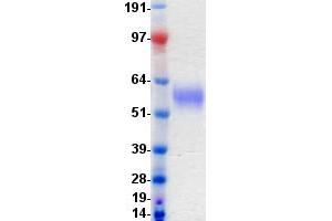 Western Blotting (WB) image for Discoidin Domain Receptor tyrosine Kinase 2 (DDR2) protein (DYKDDDDK-His Tag) (ABIN2713458)