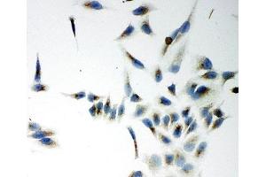 ICC testing of NOX5 antibody and HeLa cells (NOX5 antibody  (C-Term))