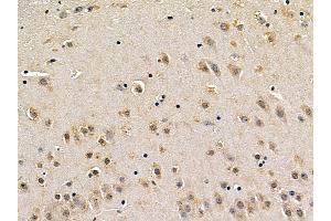 MEK1 Mouse Monoclonal Antibody at 1/100 staining mouse brain tissue by IHC-P. (MEK1 antibody  (Internal Region))