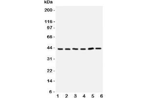 Western blot testing of TRAM antbody;  Lane 1: rat brain;  2: (r) kidney;  3: human 293T;  4: (h) Raji;  5: (h) Jurkat cell lysate. (TICAM2 antibody  (C-Term))
