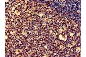 Immunohistochemistry of paraffin-embedded human tonsil tissue using ABIN7162722 at dilution of 1:100 (PDLIM2 antibody  (AA 161-284))