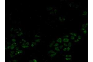 Detection of SMN in Human Hela Cells using Polyclonal Antibody to Survival Motor Neuron Protein (SMN) (SMN1 antibody  (AA 2-294))