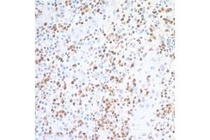 Immunohistochemistry (IHC) image for anti-Arginase, Liver (ARG1) (AA 1-322) antibody (ABIN7454020) (Recombinant Liver Arginase antibody  (AA 1-322))