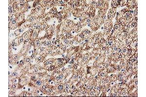Immunohistochemical staining of paraffin-embedded Human liver tissue using anti-MMAB mouse monoclonal antibody.