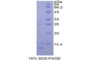 SDS-PAGE (SDS) image for Transforming Growth Factor, alpha (TGFA) (AA 24-98) protein (His tag) (ABIN1877656)