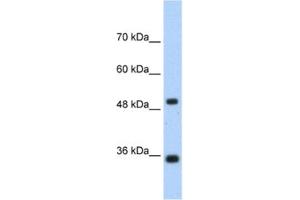 Western Blotting (WB) image for anti-Fructose-1,6-Bisphosphatase 1 (FBP1) antibody (ABIN2462400) (FBP1 antibody)