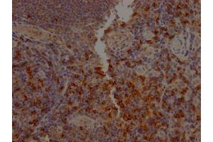 Immunohistochemistry (IHC) image for anti-CD8a Molecule (CD8A) antibody (ABIN7127409)