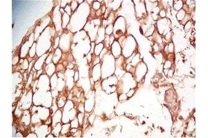 Mouse visceral fat tissue was stained by Rabbit Anti-Cathepsin S (298-331) (Human) Serum (Cathepsin S antibody  (AA 298-331))