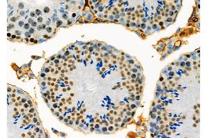 ABIN6261387 and ABIN6278336 at 1/100 staining Mouse testis tissue by IHC-P. (DUX4 antibody)