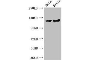 Western Blot Positive WB detected in: Hela whole cell lysate, Mouse brain tissue All lanes: RASA1 antibody at 3. (RASA1 antibody  (AA 201-500))
