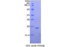 SDS-PAGE (SDS) image for Fibrillin 1 (FBN1) (AA 751-895) protein (His tag) (ABIN1877564) (Fibrillin 1 Protein (FBN1) (AA 751-895) (His tag))