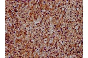 IHC image of ABIN7150800 diluted at 1:500 and staining in paraffin-embedded human adrenal gland tissue performed on a Leica BondTM system. (Dymeclin antibody  (AA 224-348))