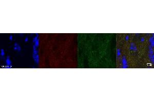 Immunohistochemistry (IHC) image for anti-Discs, Large Homolog 4 (Drosophila) (DLG4) antibody (ABIN7456070)