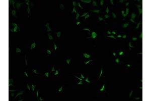 Immunofluorescence staining of SH-SY5Y cells with ABIN7152090 at 1:100, counter-stained with DAPI. (ELF2 antibody  (AA 1-353))