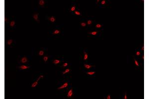 ABIN6269136 staining A549 cells by IF/ICC. (FGFR1 antibody  (C-Term))