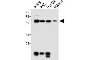All lanes : Anti-MeCP2 Antibody at 1:2000 dilution Lane 1: Jurkat whole cell lysate Lane 2: A431 whole cell lysate Lane 3: HepG2 whole cell lysate Lane 4: Mouse brain lysate Lysates/proteins at 20 μg per lane. (MECP2 antibody  (AA 400-428))