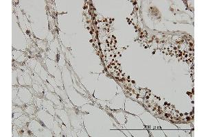 Immunoperoxidase of monoclonal antibody to TRIM33 on formalin-fixed paraffin-embedded human testis. (TRIM33 antibody  (AA 1006-1105))