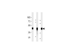 All lanes : Anti-CYK18 Antibody (C-term) at 1:2000 dilution Lane 1: HepG2 whole cell lysates Lane 2: K562 whole cell lysates Lane 3: NCI- whole cell lysates Lysates/proteins at 20 μg per lane.