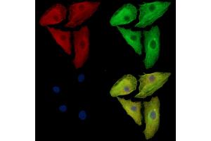 ABIN7097138 and ABIN7101206 staining  cells by IF/ICC.
