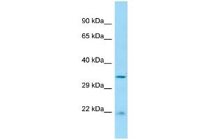 WB Suggested Anti-RGD1306739 Antibody Titration: 1. (Cabcoco1 antibody  (C-Term))
