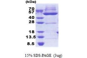 3-Oxoacyl-ACP Synthase, Mitochondrial (OXSM) (AA 28-459) protein (His tag)