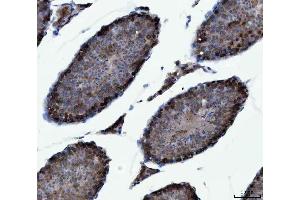 IHC analysis of CAD using anti-CAD antibody (ABIN7600044).