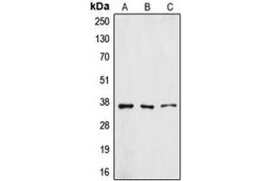 Western blot analysis of ZFP36L1 expression in A431 (A), HuvEc (B), A549 (C) whole cell lysates. (ZFP36L1 antibody  (Center))