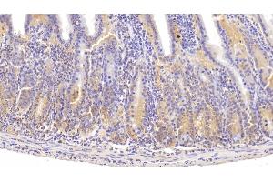 Detection of ITGa1 in Mouse Small intestine Tissue using Polyclonal Antibody to Integrin Alpha 1 (ITGa1) (Integrin alpha 1 antibody  (AA 103-368))