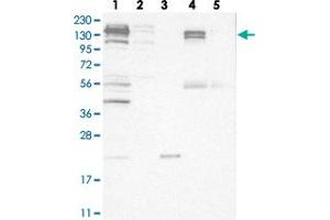 Western blot analysis of Lane 1: RT-4, Lane 2: U-251 MG, Lane 3: Human Plasma, Lane 4: Liver, Lane 5: Tonsil with CGN polyclonal antibody  at 1:250-1:500 dilution. (Cingulin antibody)