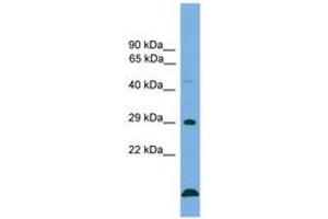 Image no. 1 for anti-B-Cell CLL/lymphoma 2 (BCL2) (AA 85-134) antibody (ABIN6745511) (Bcl-2 antibody  (AA 85-134))