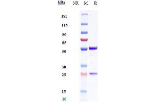 Anti-IFNg Reference Antibody (AMG 811) on SDS-PAGE under reducing (R) condition.