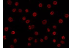 ABIN6266702 staining HuvEc by IF/ICC. (CLOCK antibody  (Internal Region))