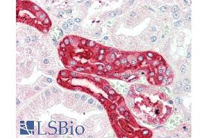 ABIN5539884 (5µg/ml) staining of paraffin embedded Human Kidney. (MEX3C antibody  (AA 541-554))