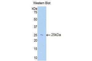Western Blotting (WB) image for anti-TIMP Metallopeptidase Inhibitor 3 (TIMP3) (AA 27-209) antibody (ABIN1860762) (TIMP3 antibody  (AA 27-209))