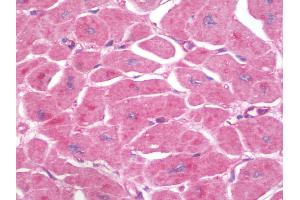 Anti-CD59 antibody IHC staining of human heart.